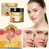 Natural Bee Venom Skin Treatment Cream for Effective Fast Acting Relief